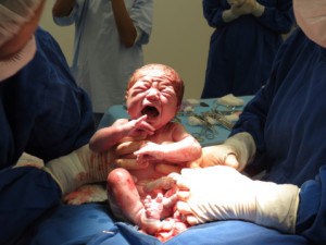 Birth Injuries from Misuse of Forceps and Vacuum Extraction